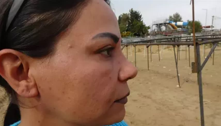 عملية تجميل فاشلة تحول حياة أربعينية إلى كابوس