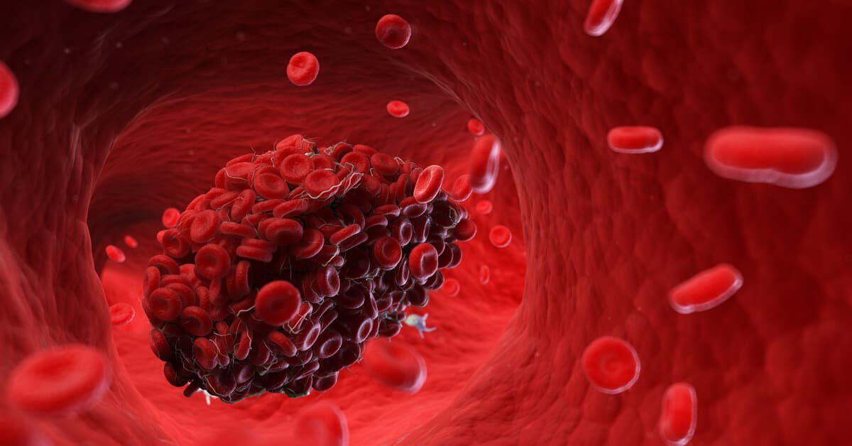 أطعمة تحارب الخثرات الدموية