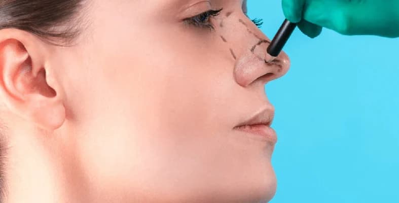 الفصل المناسب لإجراء عملية تجميل الأنف وأحدث التقنيات