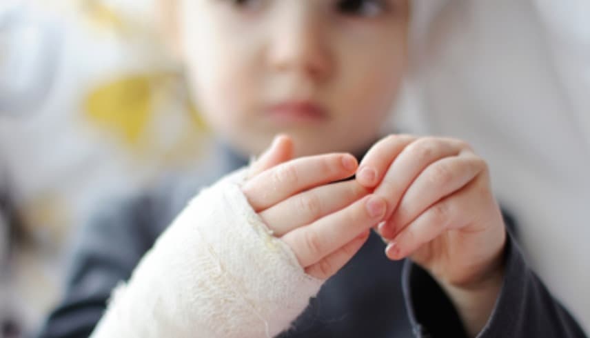 مصر.. أب يحرق طفله بسبب الواجبات المدرسية