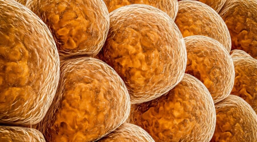 اكتشاف آلية لمكافحة السمنة بتنشيط «الدهون البنية»