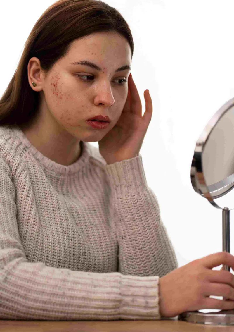 لماذا تزداد حبوب الوجه في الشتاء؟ أسباب خفية وأخطاء تجعلها أسوأ